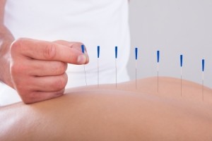 Acupuncture Toronto